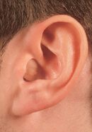 Picture of a Person wearing a Hearing Aid