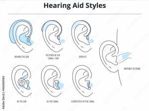 Hearing aid styles Behind the Ear, Receiver in the canal/ear, Open fit, In the ear, In the canal, Completely in the canal, Invisible in the canal