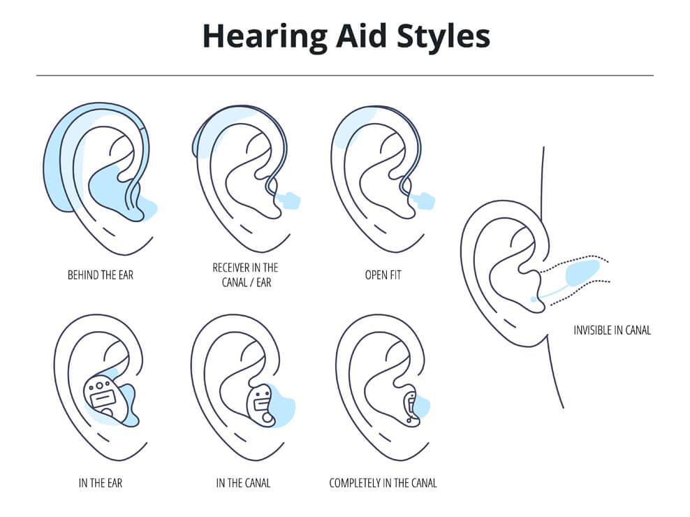 Types Of Hearing Aids For The Hearing Impaired And The Deaf.different Hearing Aid Technology.vector Flat Illustration